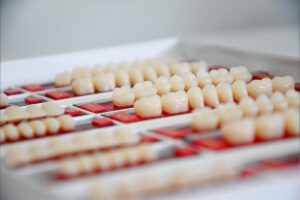 Read more about the article What to Look for When Choosing a Dentist for Dental Veneers